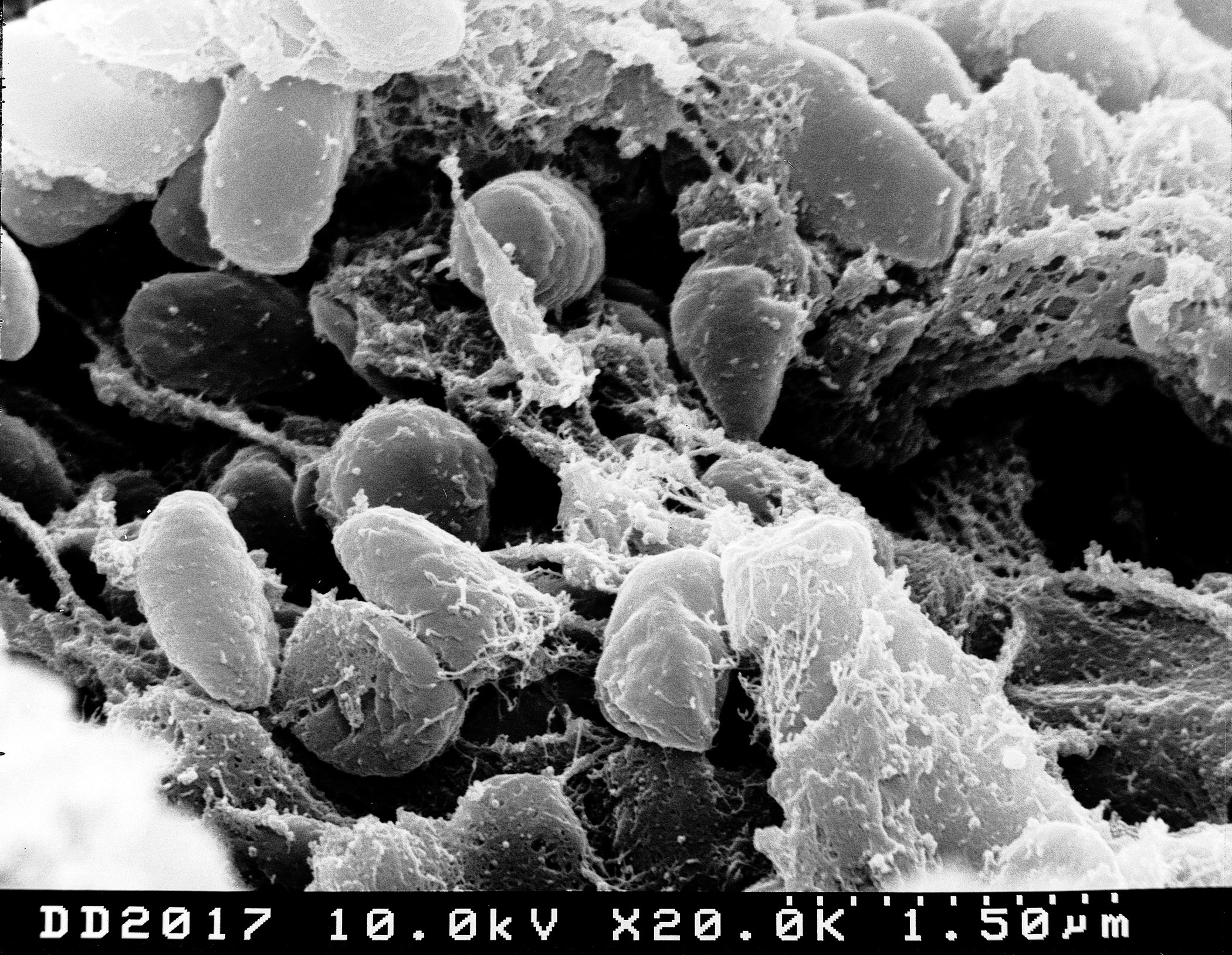Electron Microscope Image of metals